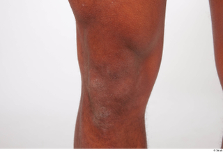 Nabil knee 0004.jpg